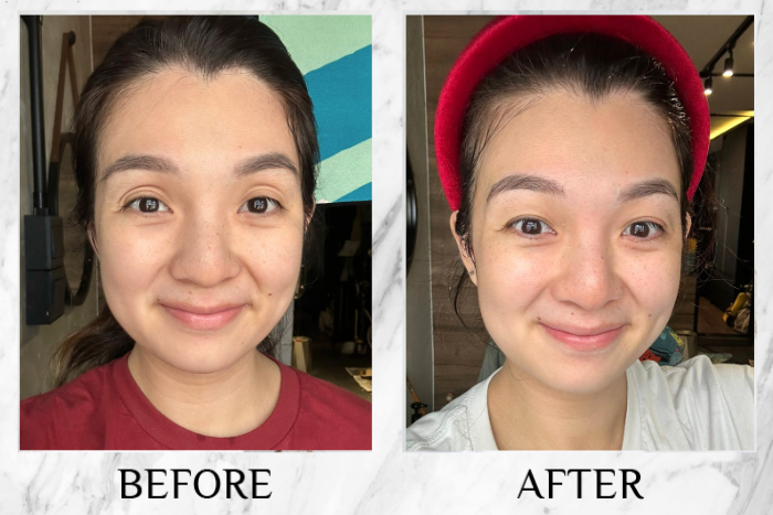 Before & after real reviews of Lustre White NMN Beauty Shot