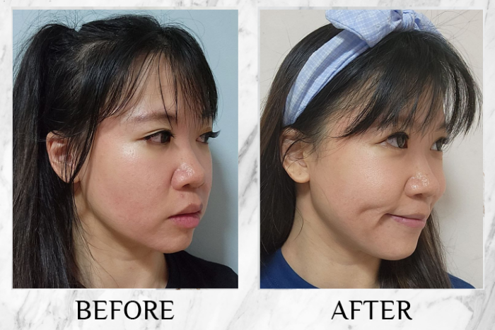 Before & after real reviews of Lustre White NMN Beauty Shot