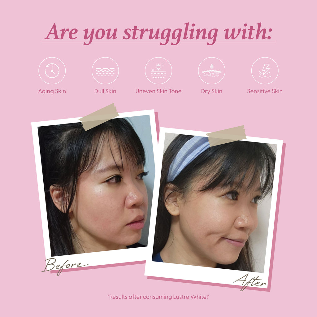 Lustre White NMN Beauty Shot