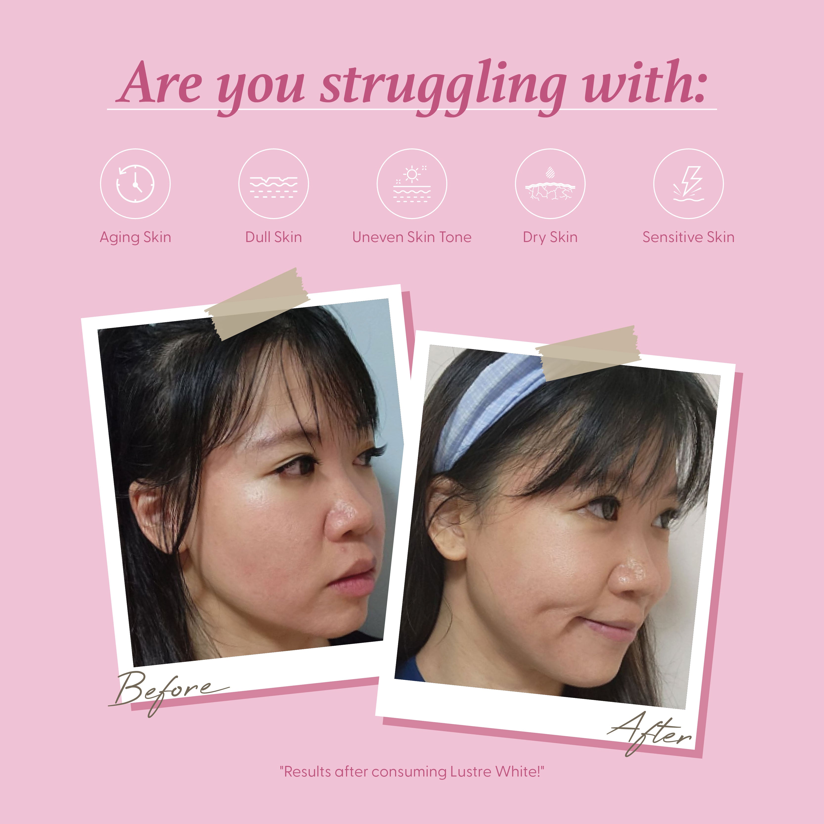 Lustre White NMN Beauty Shot