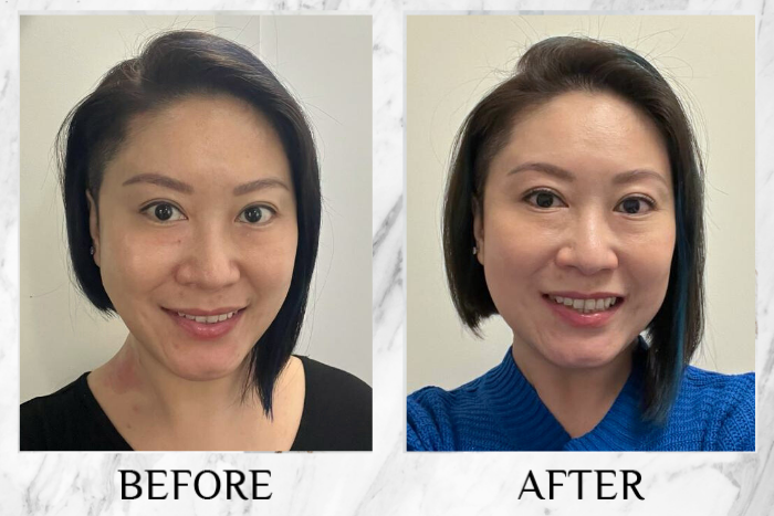 Before & after real reviews of Lustre White NMN Beauty Shot